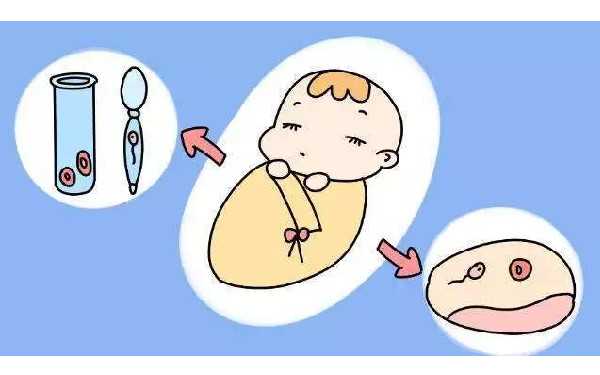 合肥混血模特捐卵 合肥办理流动人口婚育证明的材料和流程 ‘孕囊大小能看出